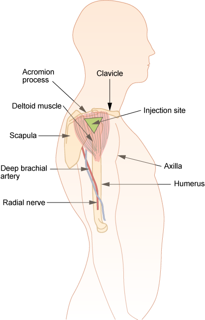 Intramuscular deltoid injection procedure