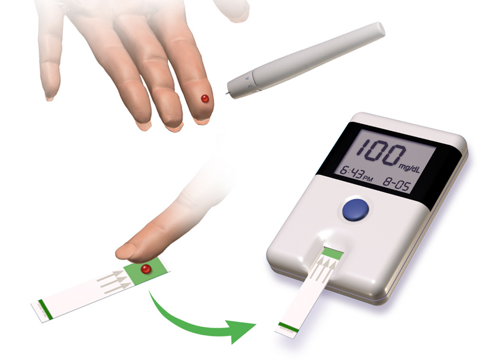 Type 2 Diabetes Mellitus clinical reference visual