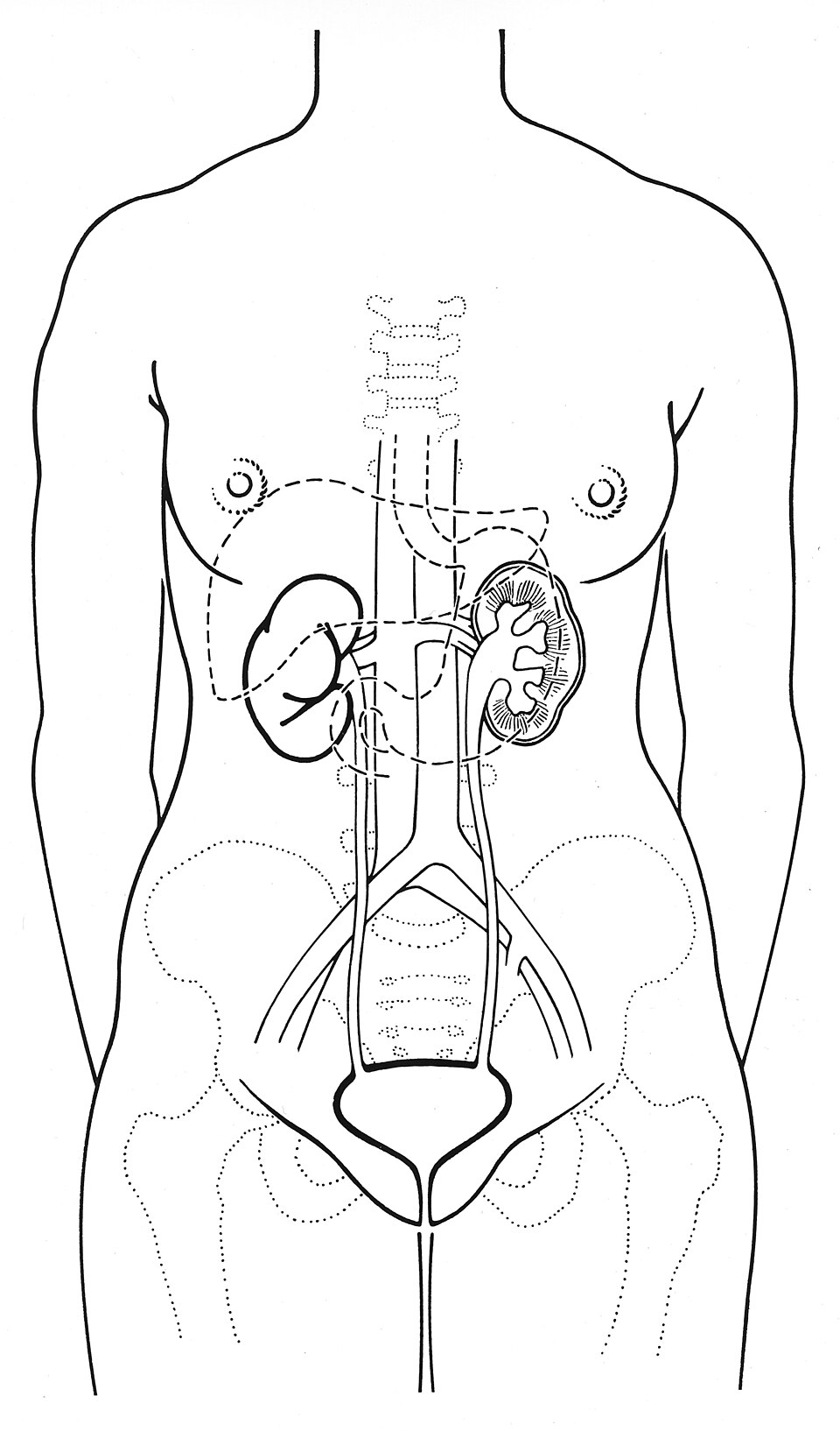 Overactive Bladder clinical reference photography