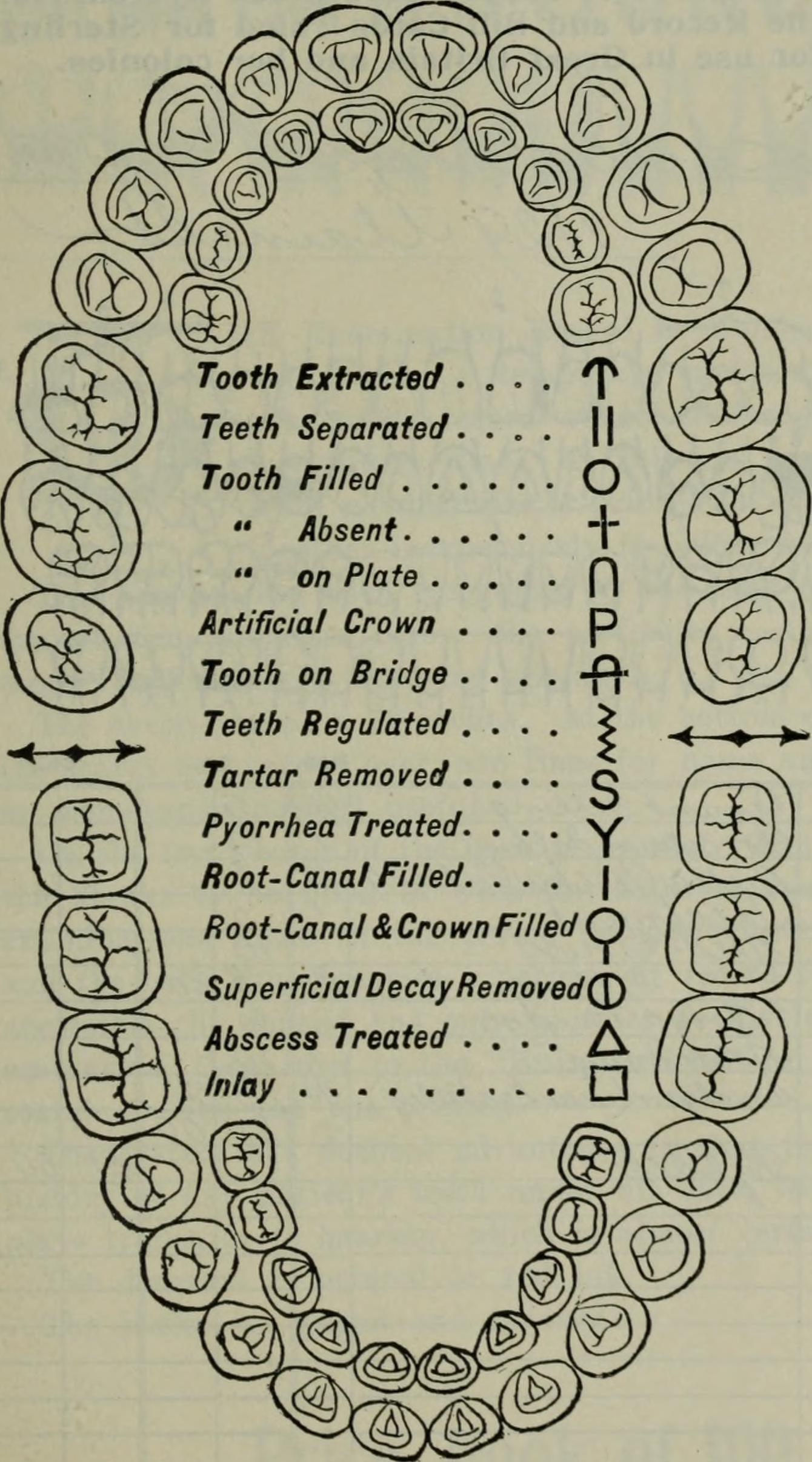 Clinical dental examination evaluating biological natural tooth vs titanium dental implant